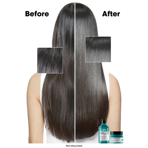  L'oréal Professionnel Série Expert Scalp Advanced Masque Capillaire à L'argile Purifiant Régulateur De Sébum 2-en-1 250 ml 