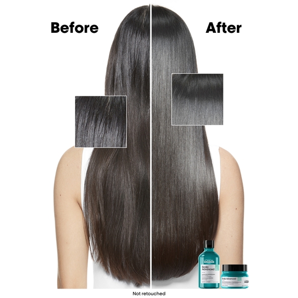  L'oréal Professionnel Série Expert Scalp Advanced Shampooing Dermo-purifiant Régulateur De Sébum 300 ml 