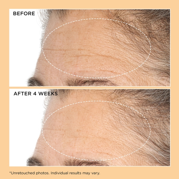  Perricone Md Neuropeptide Deep Crease Serum 