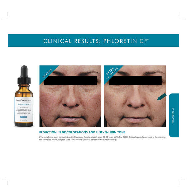  Skinceuticals Phloretin cf Sérum Antioxydant Pour Peaux Normales, Mixtes Ou Sujettes à La Décoloration 